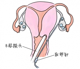 幼儿学画画，南宁捐卵宝宝学画画，学画画的好处，如何学画画