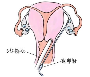 幼儿学画画，南宁捐卵宝宝学画画，学画画的好处，如何学画画